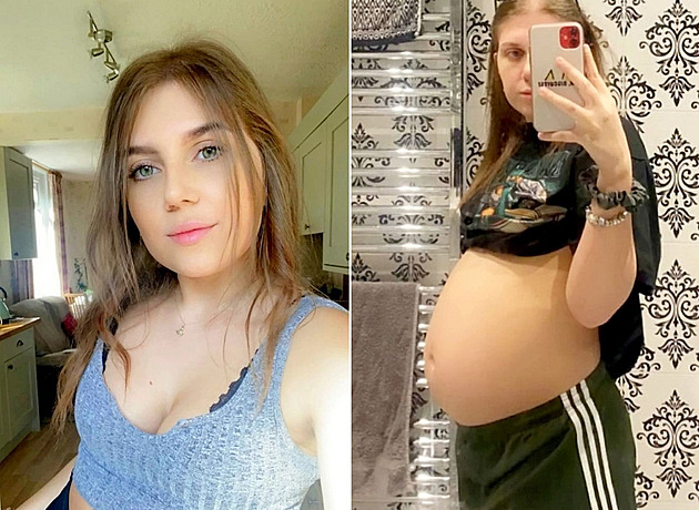 Žena vypadala jako těhotná, za velikost břicha ale mohla cysta