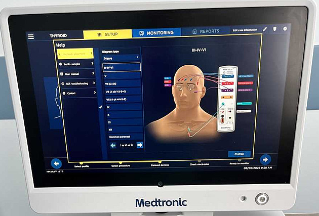 Chirurgům při operacích štítné žlázy pomáhá nový neuromonitor, přijel z USA