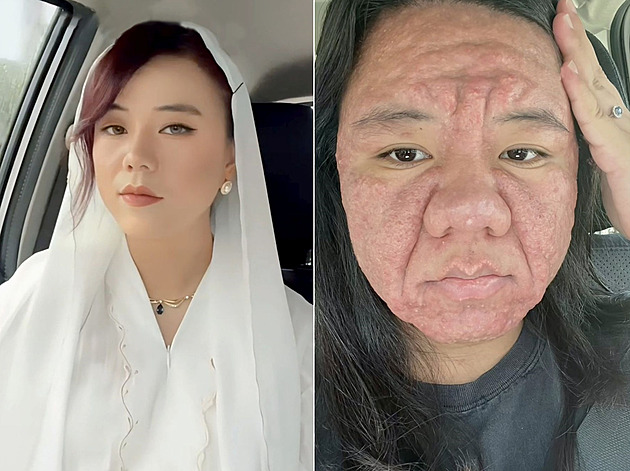 V těhotenství se žena změnila k nepoznání, šokovala i vlastní rodinu