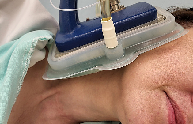 Horkem proti rakovině. Zahřívané nádory doslova mizí před očima, líčí zdravotnice